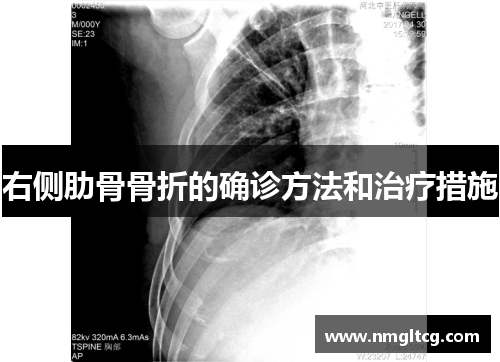 右侧肋骨骨折的确诊方法和治疗措施